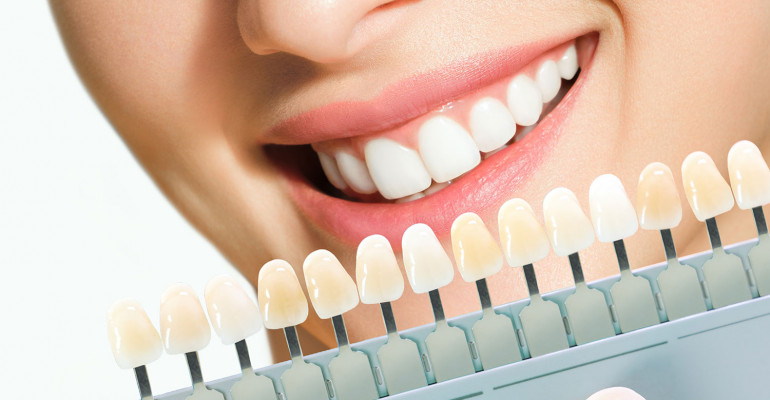 Dental Aesthetics in Taksim