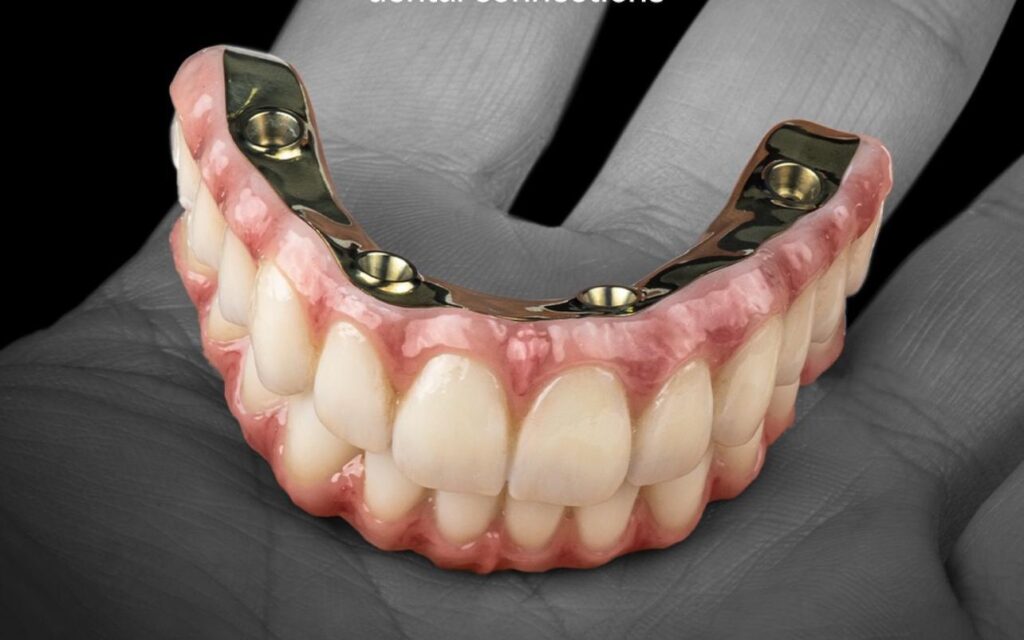 All-on-4 Dental Implant System