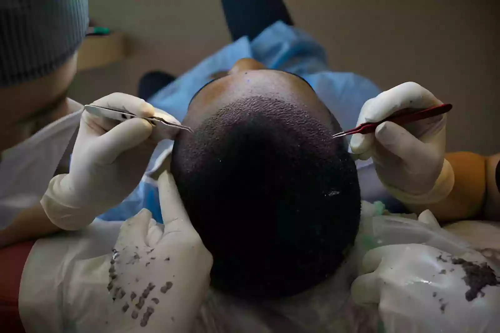 Curly follicle structure in Afro-textured hair