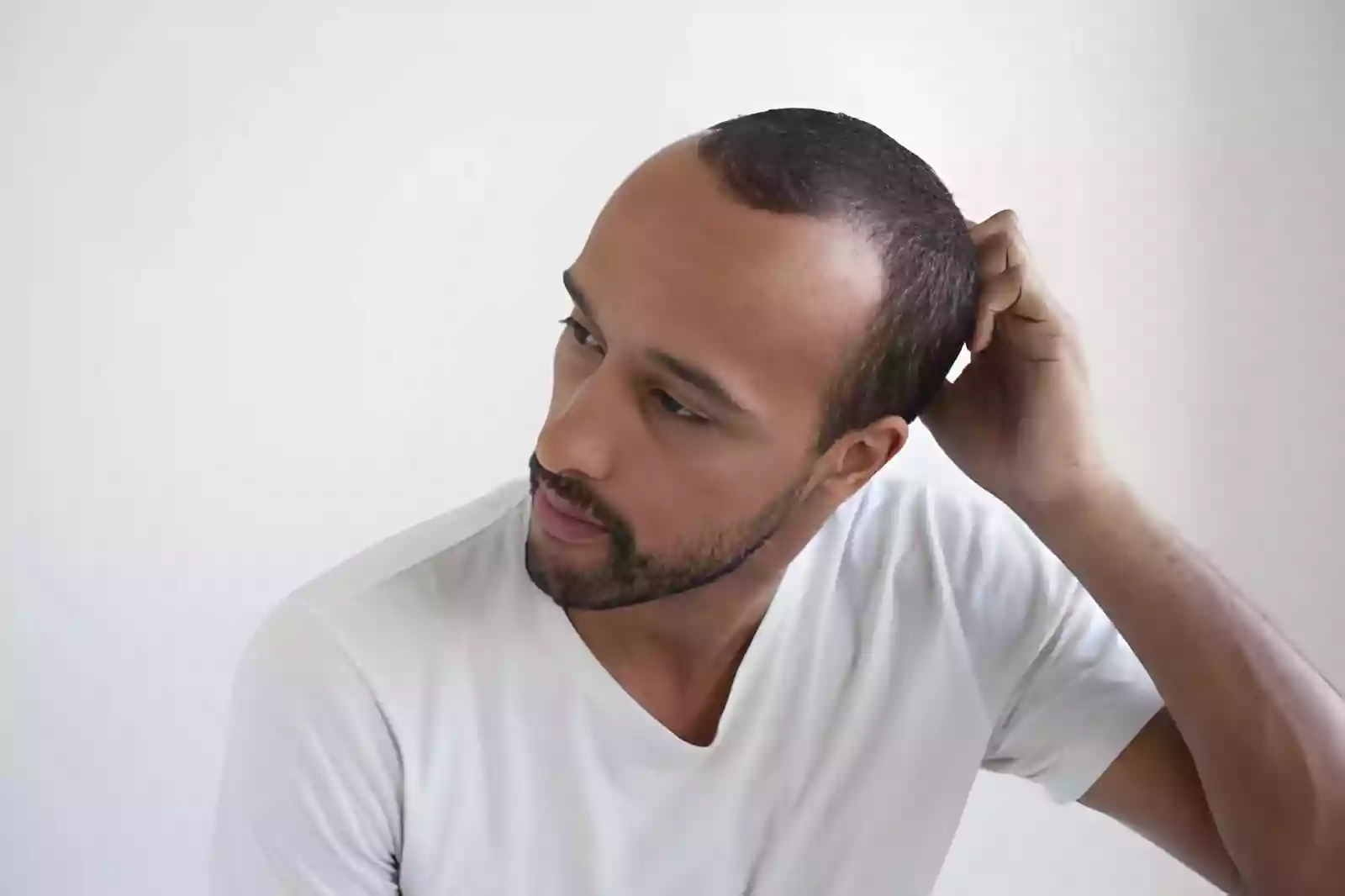 Planning a hair restoration trip to Taksim Istanbul