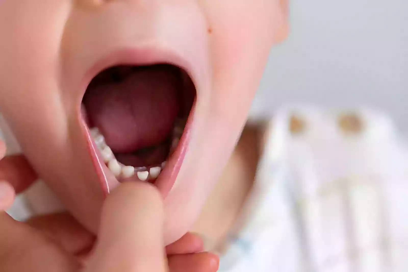 Dentist in Taksim discussing dental treatment options