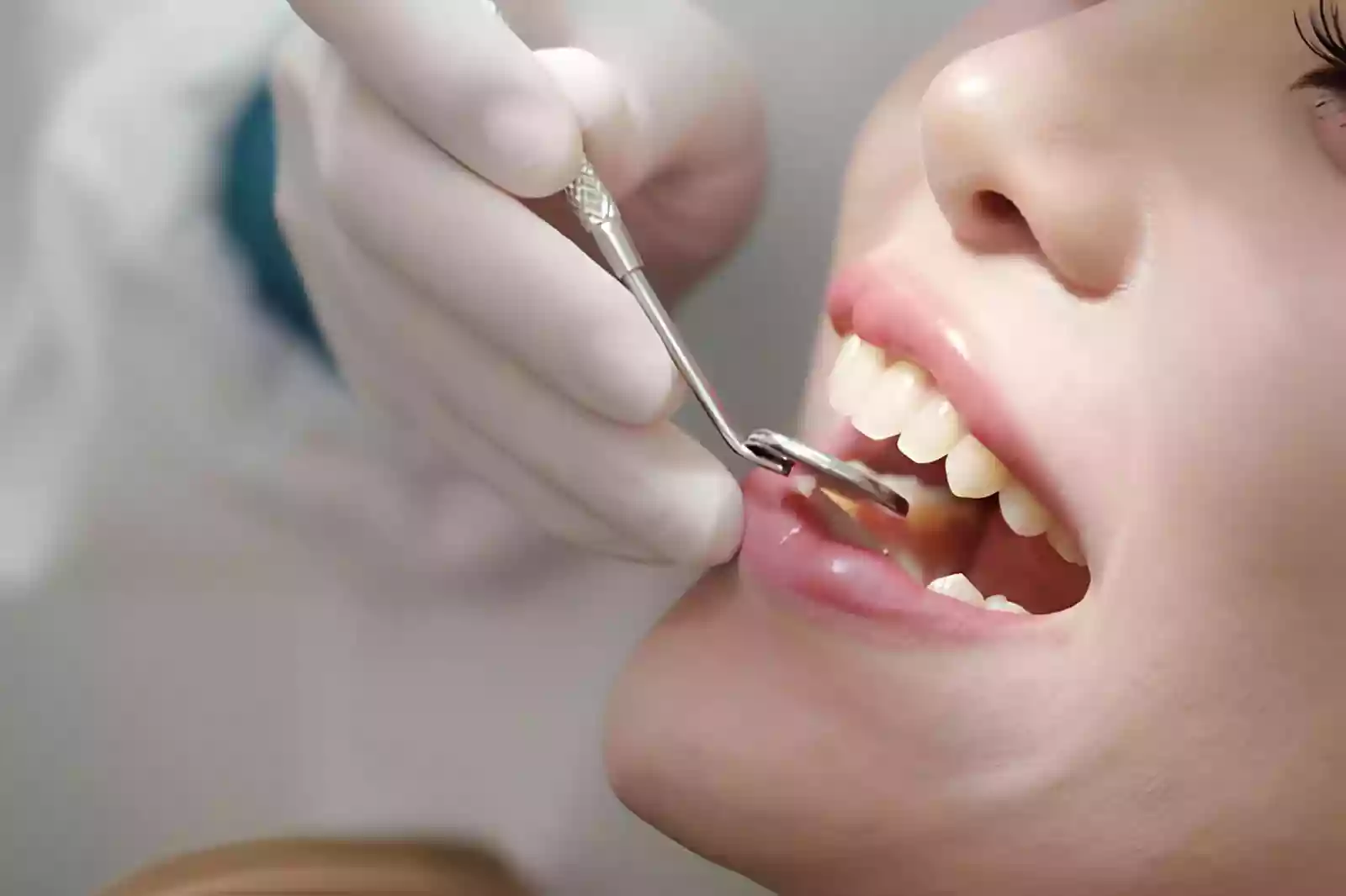Dental treatment planning and cost discussion in Taksim Istanbul