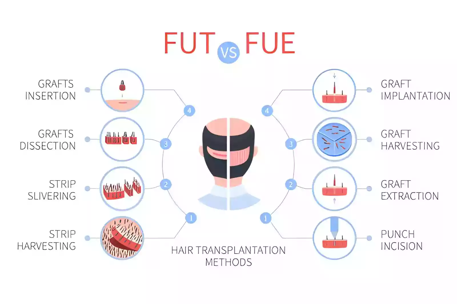 FUE hair transplant cost planning